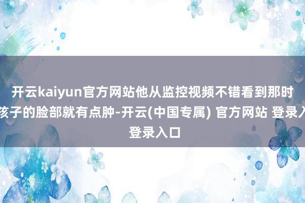 开云kaiyun官方网站他从监控视频不错看到那时辰孩子的脸部就有点肿-开云(中国专属) 官方网站 登录入口